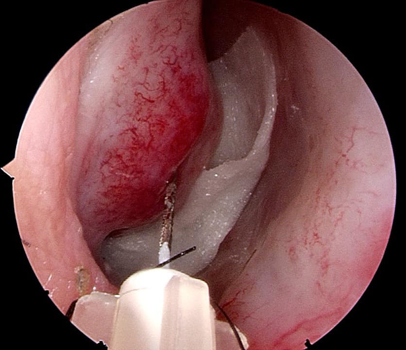 482134892 663994819489436 8353035999623728597 N