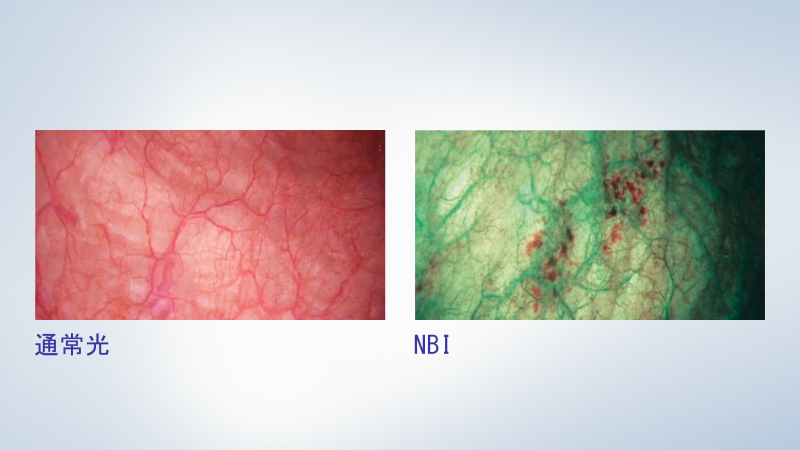 Cyf Vh White Light Clinical Picture 5274 37131