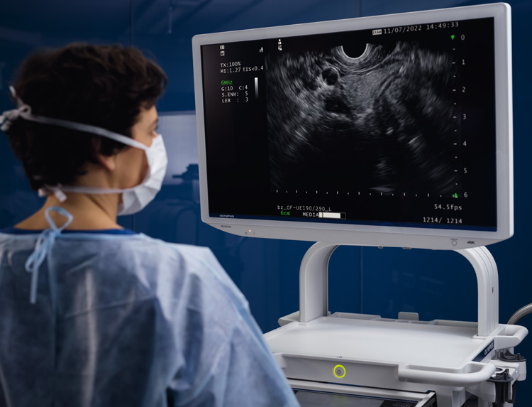 Eu Me3 Improved Diagnostic Imaging Slider