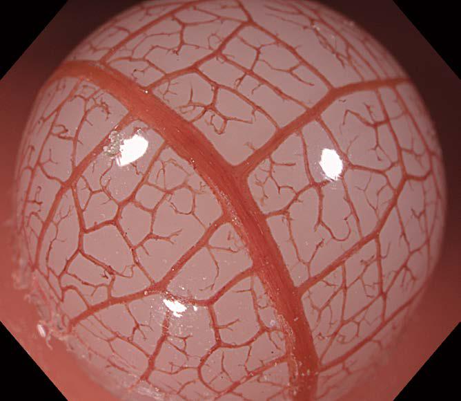 Cf Xz1200l White Light