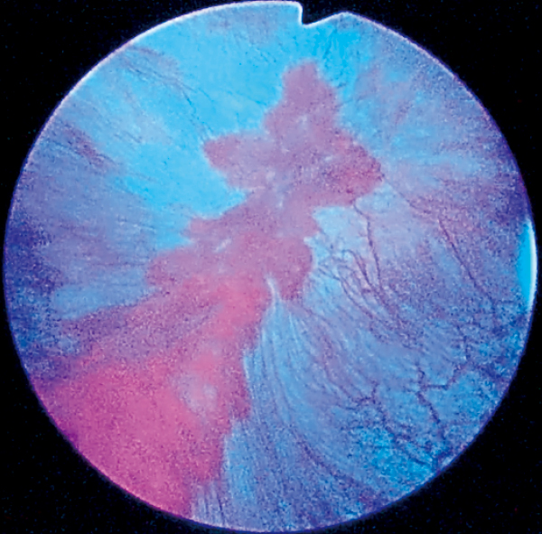 Blue Light