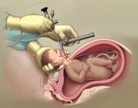 Exit Image
