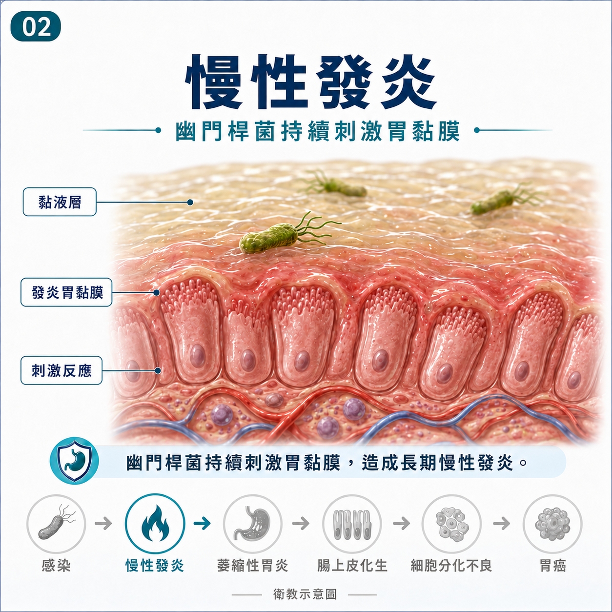 慢性發炎