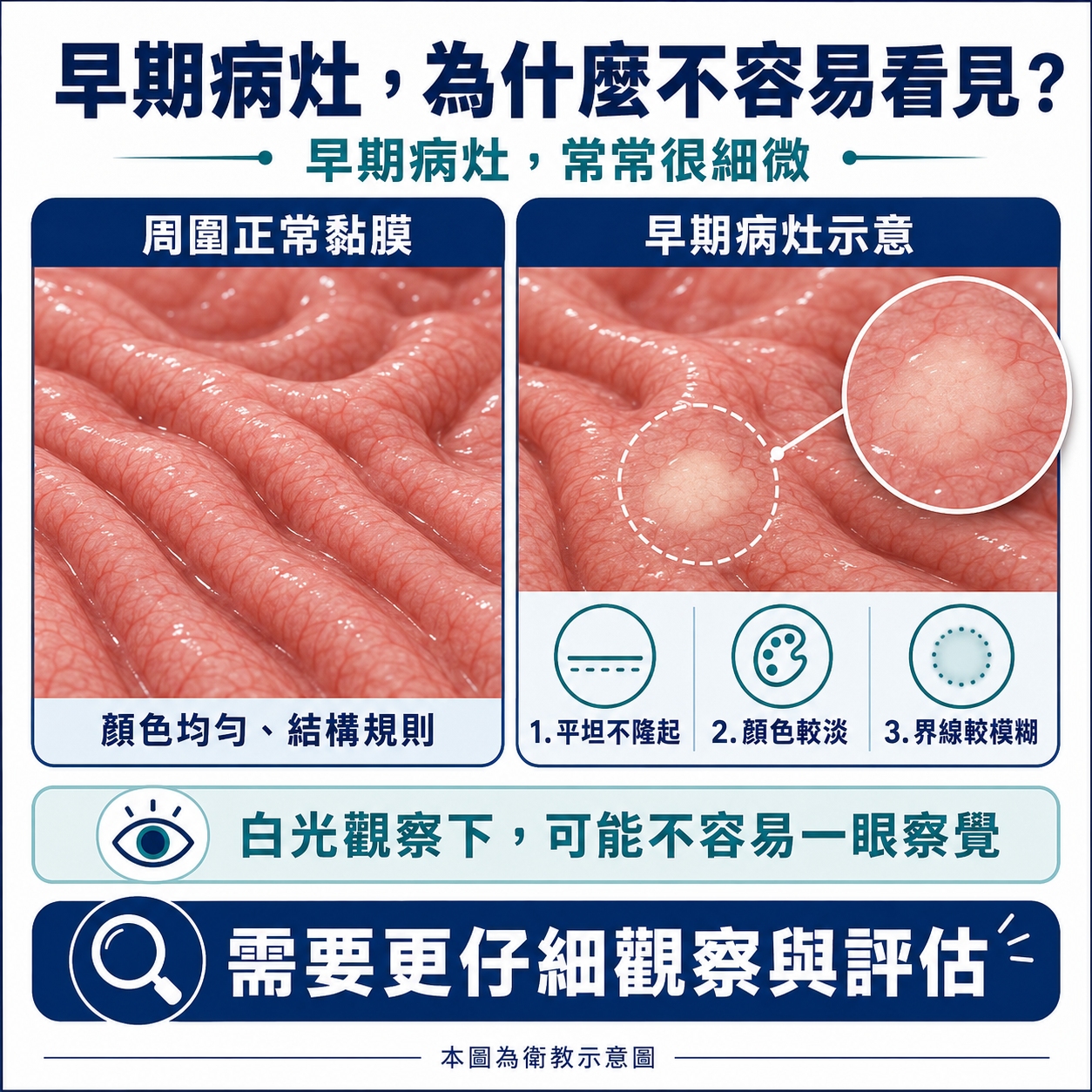 早期病灶