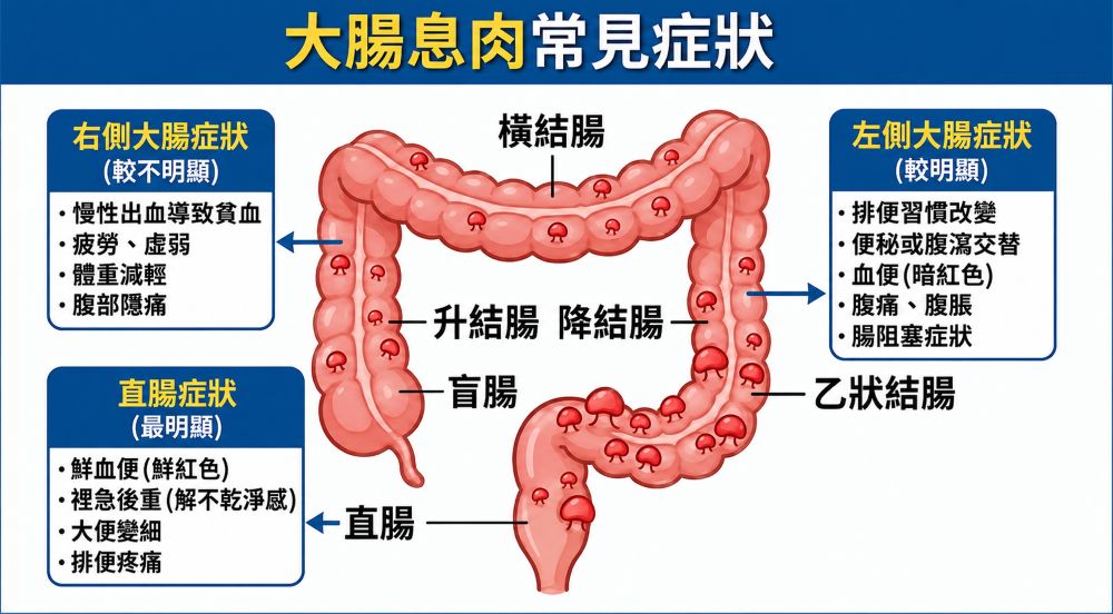 大腸常見症狀