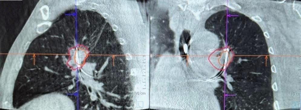 Cbct (1)