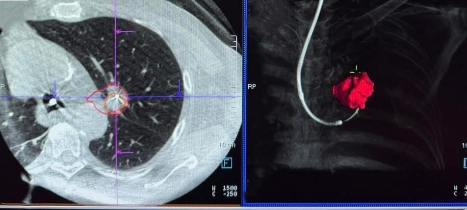 Cbct (3)