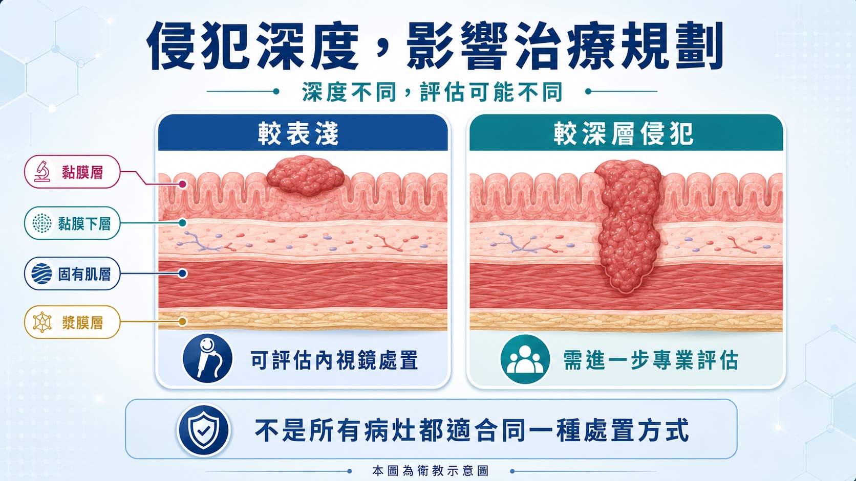 侵犯深度 滿版