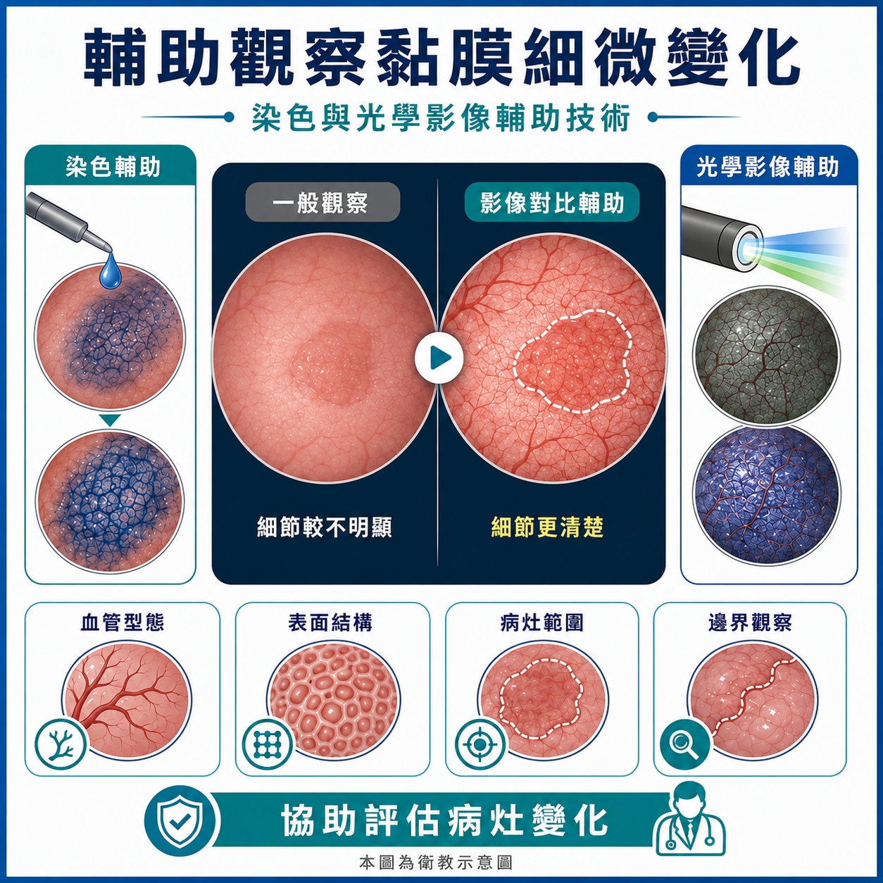 輔助觀察黏膜細微變化