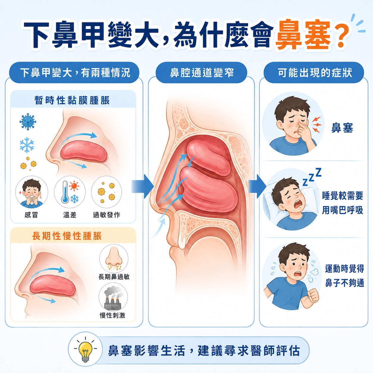 影片3小圖 2. 下鼻甲變大, 為什麼會鼻塞