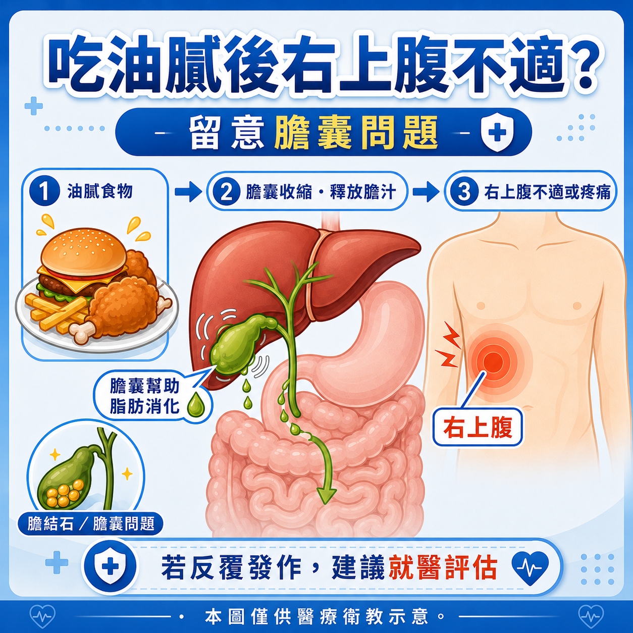 小圖 圖4. 吃油膩後右上腹不適